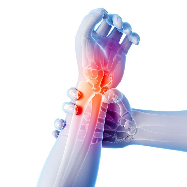 Osteoartrite