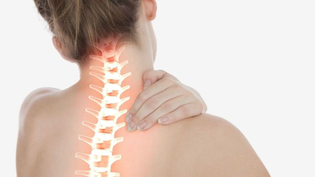 Osteocondrose da rexión do cérvix